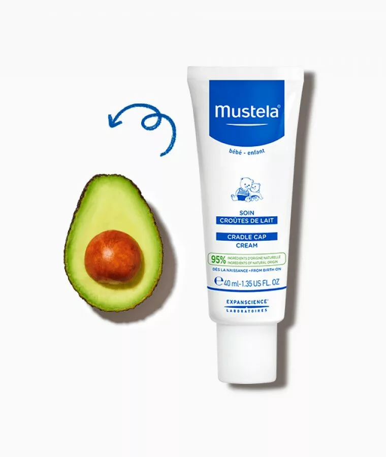 Cradle Cap Cream