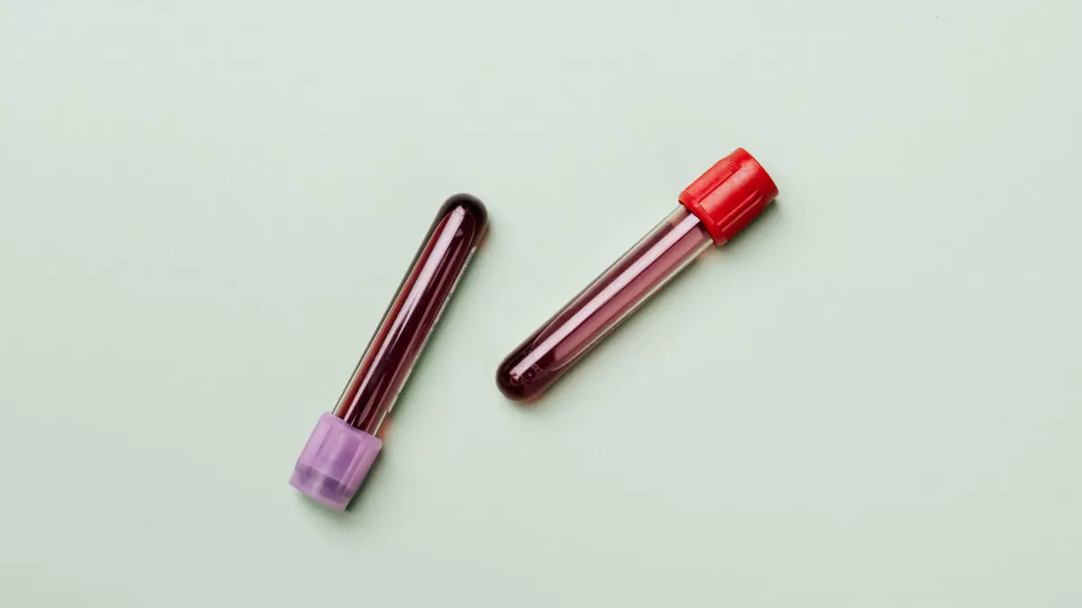 anemia during pregnancy