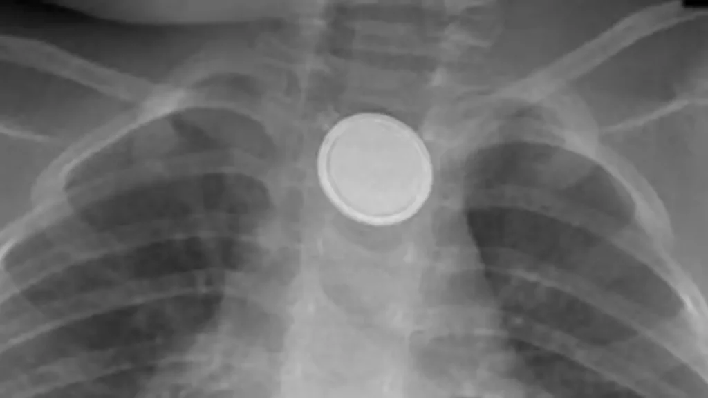 Button batteries