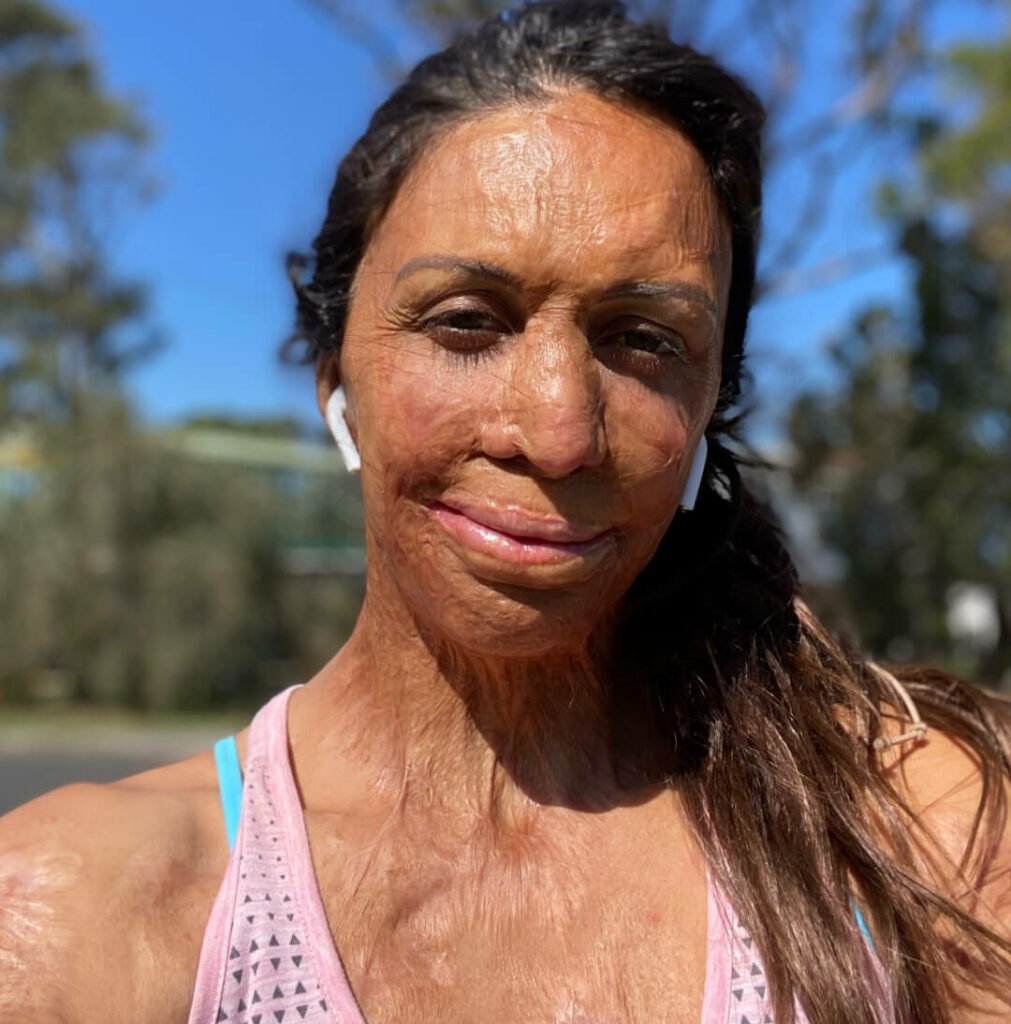 Turia Pitt