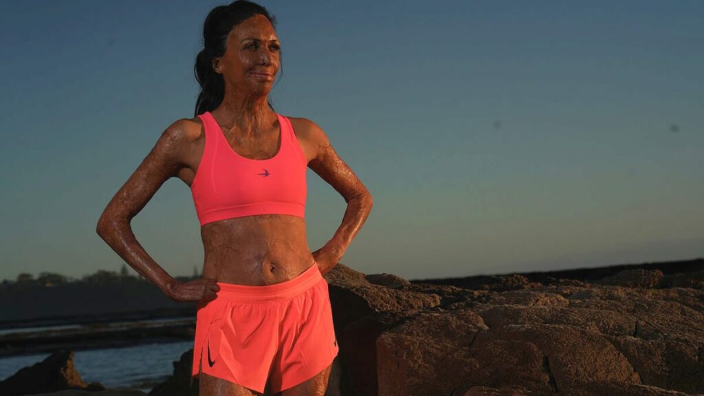 Turia Pitt