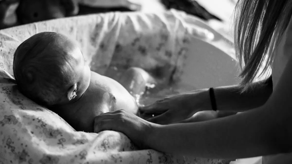 treating babies for burns and scalds