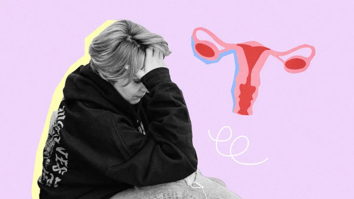 Premenstrual Dysphoric Disorder