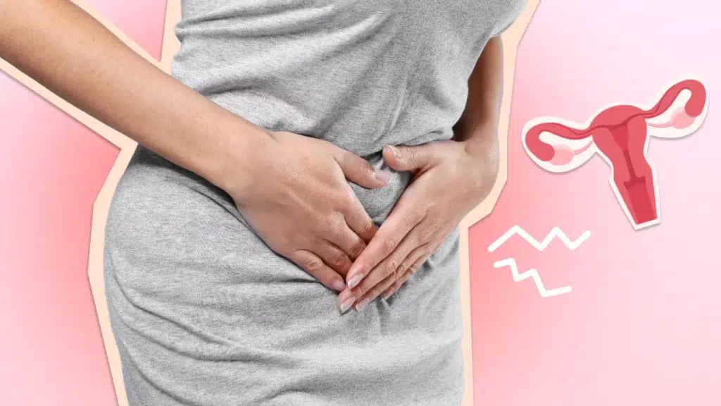 endometriosis