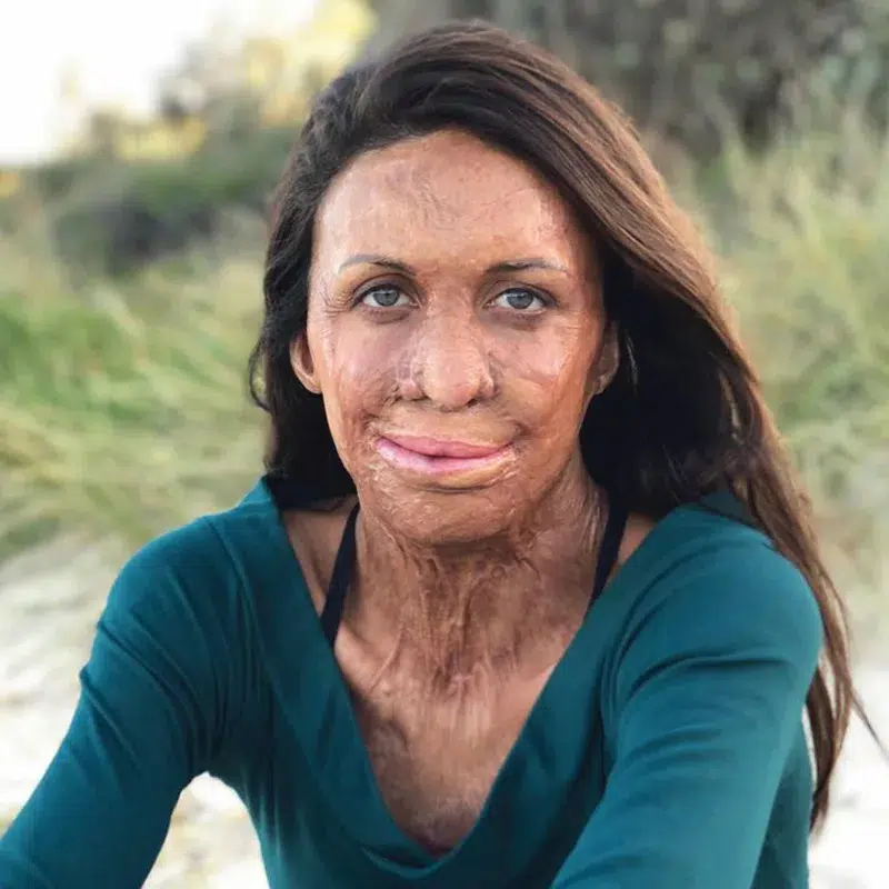 Turia Pitt