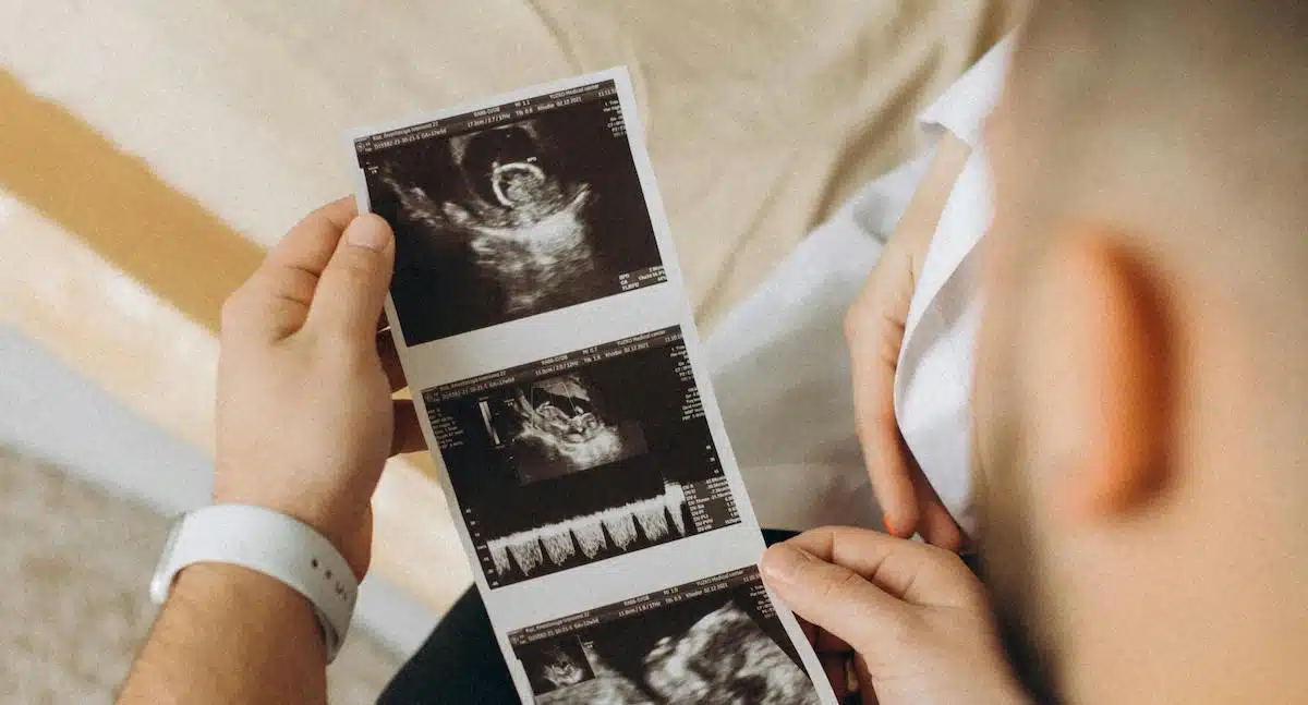 What making an informed decision really looks like in pregnancy